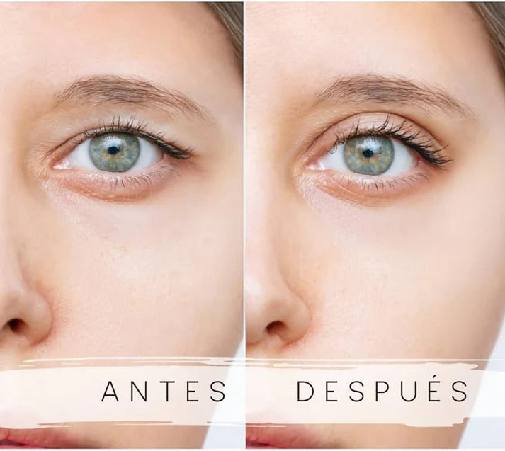 EYELID® LEVANTAPÁRPADOS X120 UNIDADES + ¡OBSEQUIO ESPECIAL! 🎁